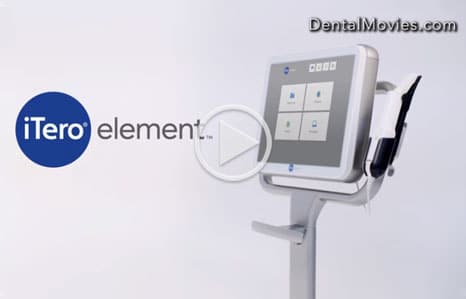 iTero-Digital-Impressions-Video-Thumbnail-Gottsegen-Orthodontics